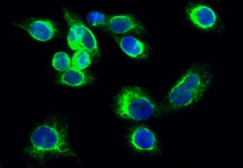 JAK3 rabbit pAb Antibody