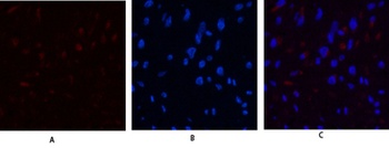 JAK3 rabbit pAb Antibody