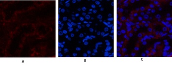 JAK3 rabbit pAb Antibody