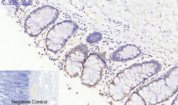 JAK3 rabbit pAb Antibody