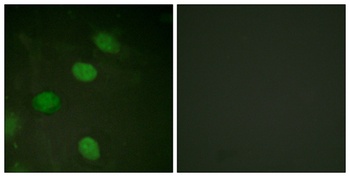 AP-1 (phospho Thr231) rabbit pAb Antibody