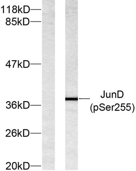 Jun D (phospho Ser255) rabbit pAb Antibody