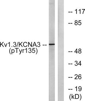 Kv1.3 (phospho Tyr187) rabbit pAb Antibody