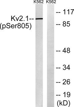 KV2.1 (phospho Ser805) rabbit pAb Antibody