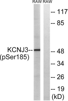 KIR3.1 (phospho Ser185) rabbit pAb Antibody