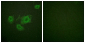 KIR6.2 (phospho Thr224) rabbit pAb Antibody