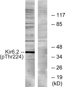KIR6.2 (phospho Thr224) rabbit pAb Antibody