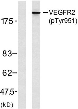 Flk-1/VEGFR2 (phospho Tyr951) rabbit pAb Antibody