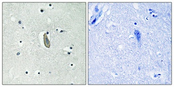 c-Kit (phospho Tyr936) rabbit pAb
