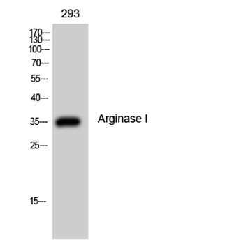 Arginase I rabbit pAb Antibody