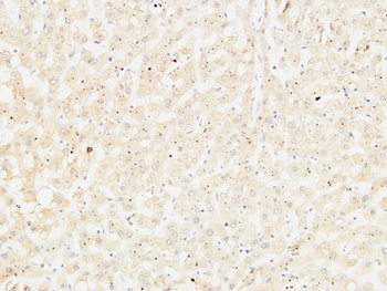 Arginase I rabbit pAb Antibody