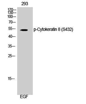 Cytokeratin 8 (phospho Ser432) rabbit pAb Antibody