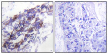 Cytokeratin 8 rabbit pAb Antibody