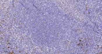 NCAM-L1 (phospho Ser1181) rabbit pAb Antibody