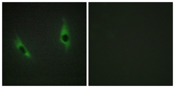 Laminin β-3 rabbit pAb Antibody