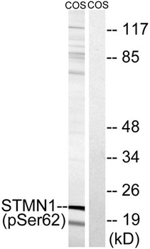 Op18 (phospho Ser62) rabbit pAb Antibody