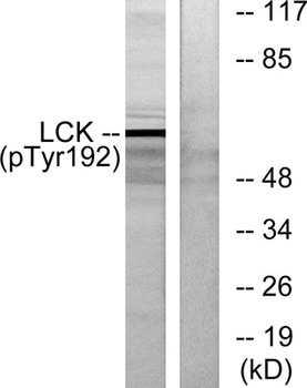 Lck (phospho Tyr192) rabbit pAb Antibody