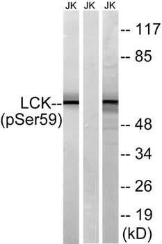Lck (phospho Ser540) rabbit pAb Antibody