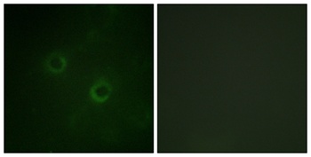 Lck rabbit pAb Antibody