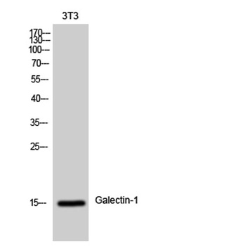 Galectin-1 rabbit pAb Antibody