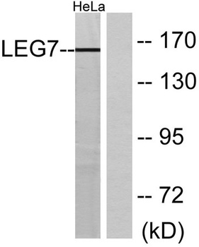 Galectin-7 rabbit pAb Antibody