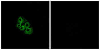 LHR rabbit pAb Antibody
