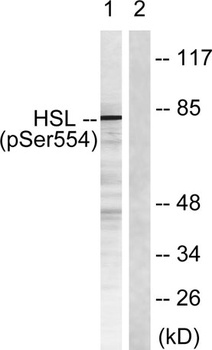 HSL (phospho Ser855) rabbit pAb Antibody