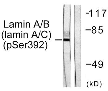 Lamin A/C (phospho Ser392) rabbit pAb Antibody