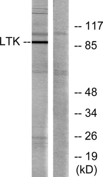 LTK rabbit pAb Antibody