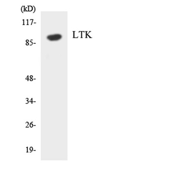 LTK rabbit pAb Antibody