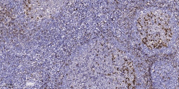 LTK rabbit pAb Antibody