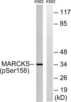 MARCKS (phospho Ser159) rabbit pAb