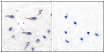 MARCKS (phospho Ser163) rabbit pAb Antibody