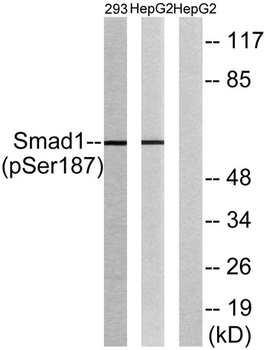 Smad1 (phospho Ser187) rabbit pAb Antibody