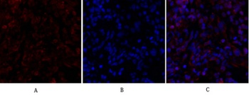 Smad4 rabbit pAb Antibody