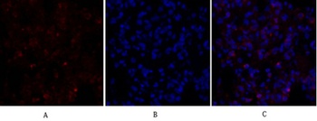 Smad4 rabbit pAb Antibody