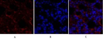 Smad4 rabbit pAb Antibody