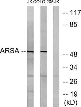 Arylsulfatase A rabbit pAb Antibody