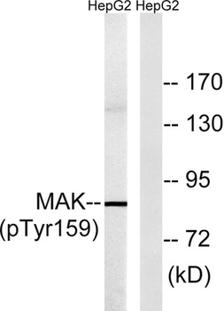 MAK (phospho Tyr159) rabbit pAb Antibody