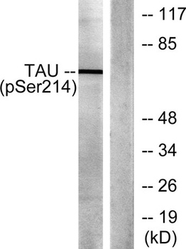 Tau (phospho Ser214) rabbit pAb Antibody