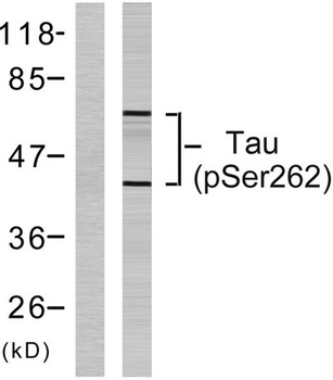 Tau (phospho Ser262) rabbit pAb Antibody