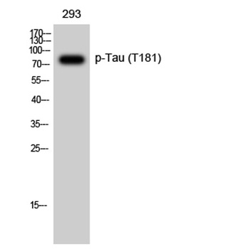 Tau (phospho Thr181) rabbit pAb Antibody