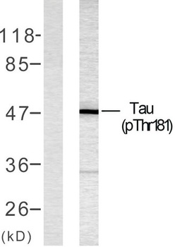 Tau (phospho Thr181) rabbit pAb Antibody