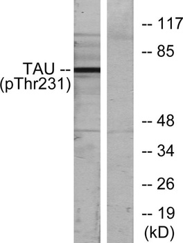 Tau (phospho Thr231) rabbit pAb Antibody