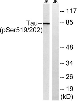 Tau (phospho Ser519) rabbit pAb Antibody