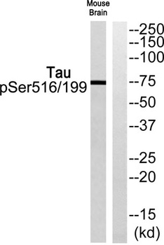 Tau (phospho Ser516/199) rabbit pAb Antibody