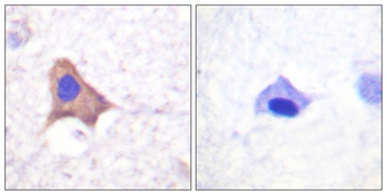 CD71/TfR (phospho Ser24) rabbit pAb