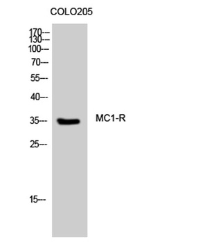 MC1-R rabbit pAb Antibody