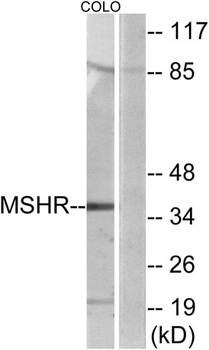 MC1-R rabbit pAb Antibody