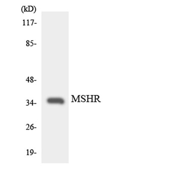 MC1-R rabbit pAb Antibody